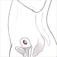 эмбрион в матке